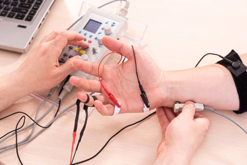 L'elettromiografia è un esame medico che valuta la funzionalità dei nervi