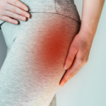 sindrome del piriforme