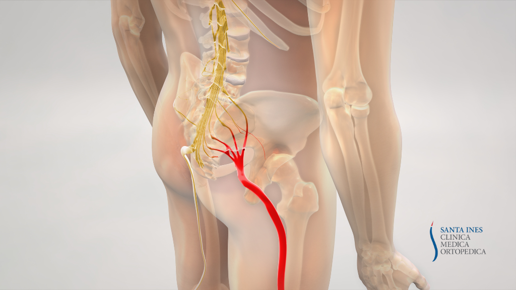 lombosciatalgia ozonoterapia